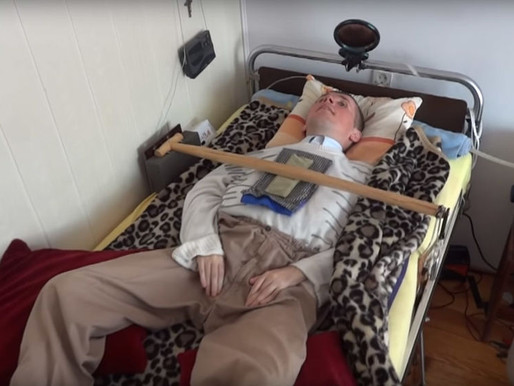 El hombre que está vivo gracias a un limpiaparabrisas que respira por él