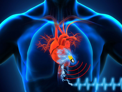 17 dispositivos implantables de Medtronic vulnerables a ciber ataques