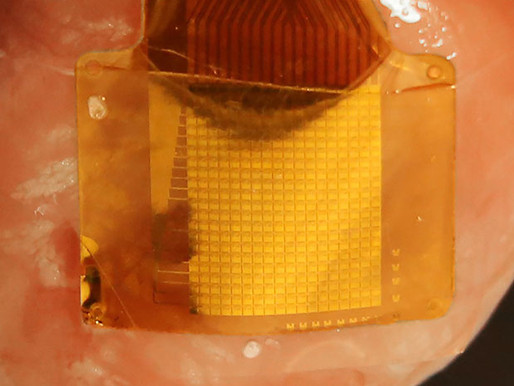Un sensor flexible que puede monitorizar tu corazón durante décadas