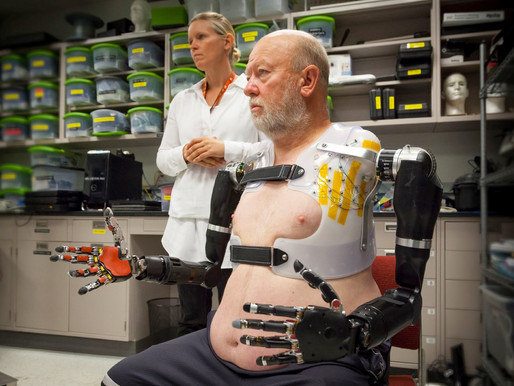 Johns Hopkins University prueba el prototipo de prótesis de doble brazo completo más sofisticado has