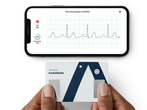 Electrocardiógrafo de una derivación en una tarjeta de crédito