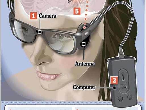 Primer ojo biónico que envía la señal directamente al cerebro