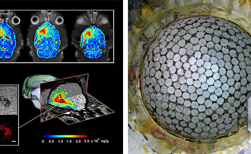 Usando ultrasonidos para llevar fármacos hasta el cerebro