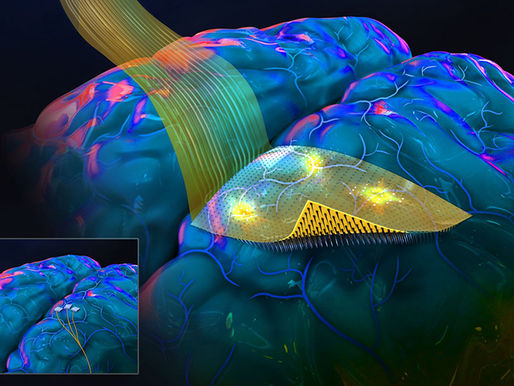 Arrays de electrodos flexibles para crear mejores interfaces cerebro-computador